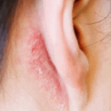 Praanah Nature Cure - Skin disorders
